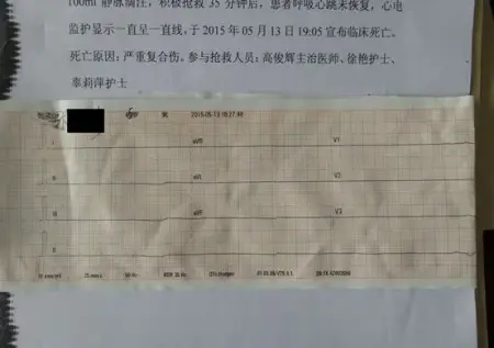 心电图检查在危重病急诊中作用论文